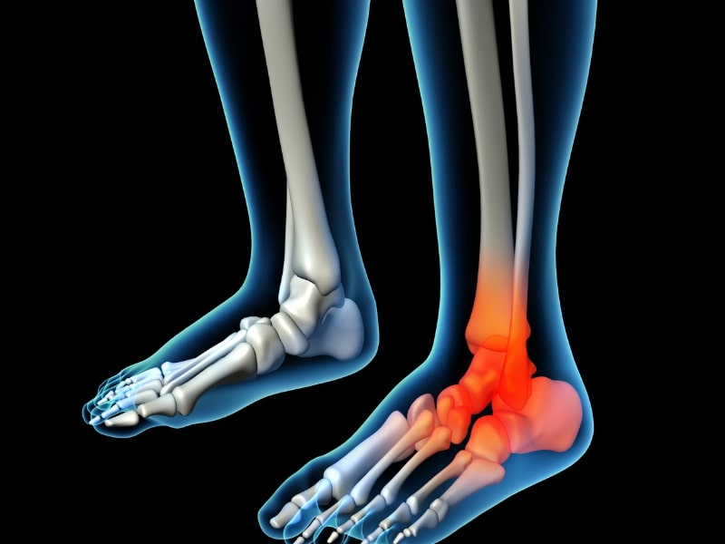 foot-injury3 foot injury