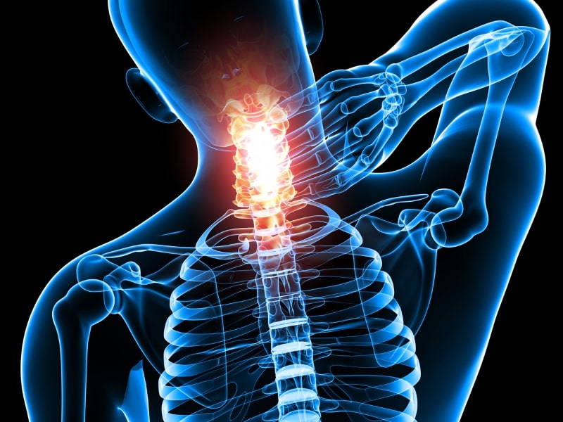 neck injury 4 neck injury